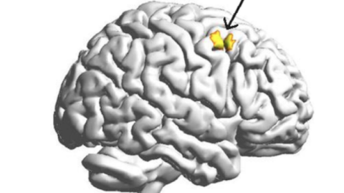 Figure of the human brain showing the location of the right dorsolateral prefrontal cortex