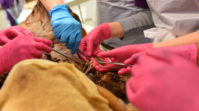 Gloved hands working near a cadaver.