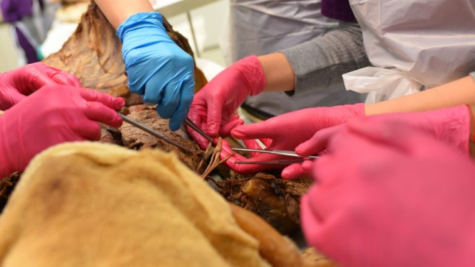 Gloved hands working near a cadaver.