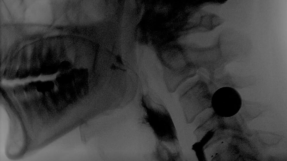 An x-ray image showing the throat and head in black and white.