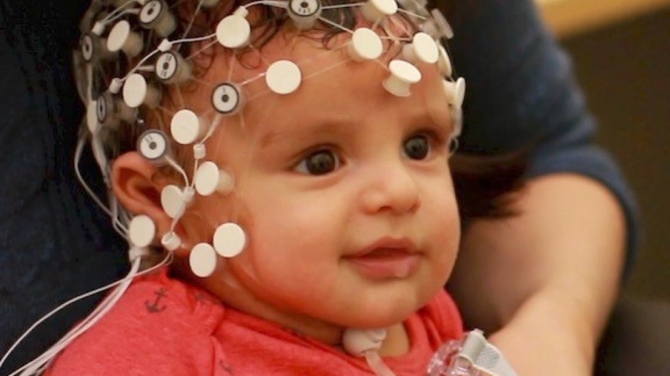 Infant wearing an electroencephalography (EEG) net which appear as white discos on it's head.